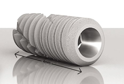 mini implant dentaire