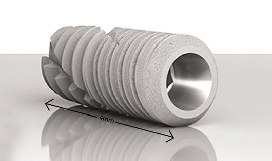 mini implant dentaire