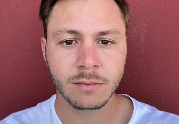 greffe de cheveux témoignage alexandre