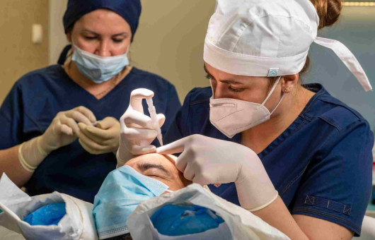 implantation d'une greffe de cheveux