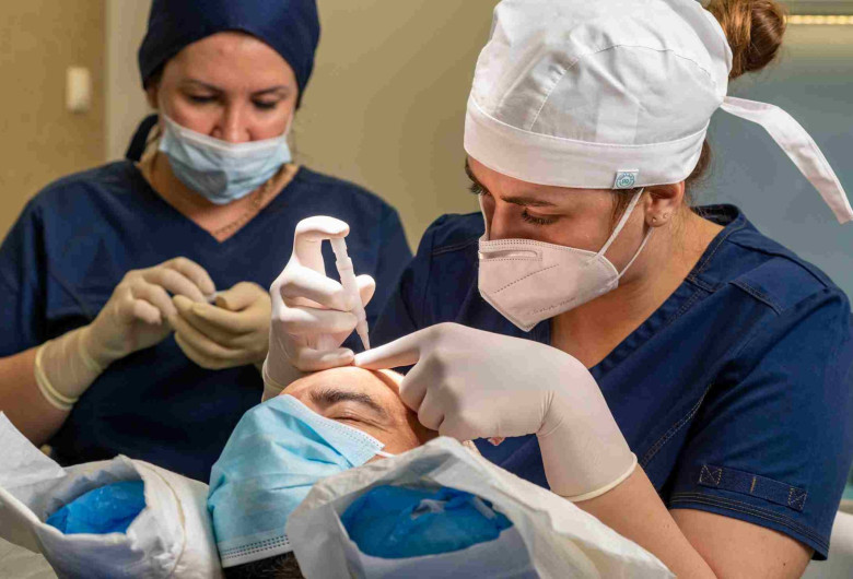 implantation d'une greffe de cheveux