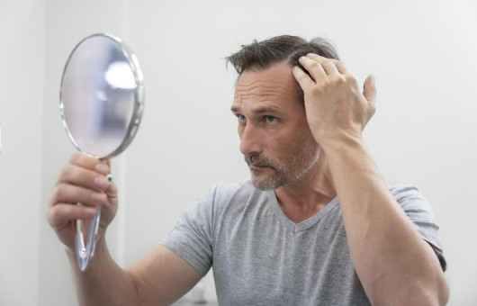 résultat greffe de cheveux 1 mois