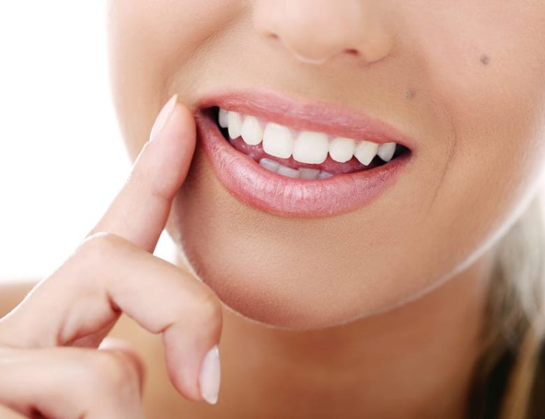 sourire de femme après un blanchiment dentaire