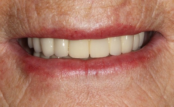 sourire après soins martine