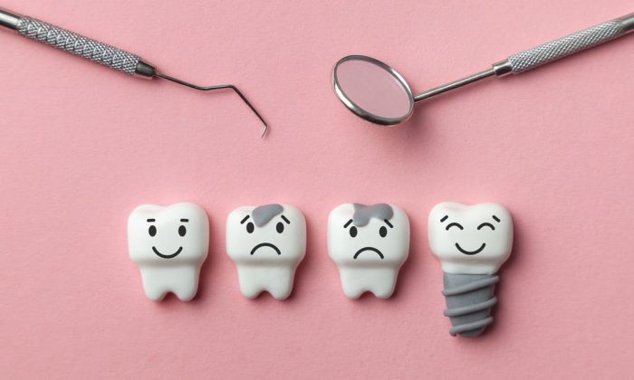 Outils dentaires et figurines de dents montrant différentes expressions pour illustrer une carie dentaire.