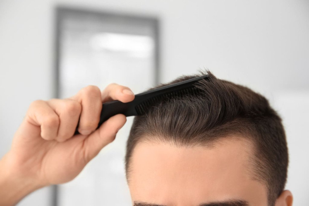 Un homme se peigne les cheveux, mettant en évidence une ligne frontale naturelle et bien définie.