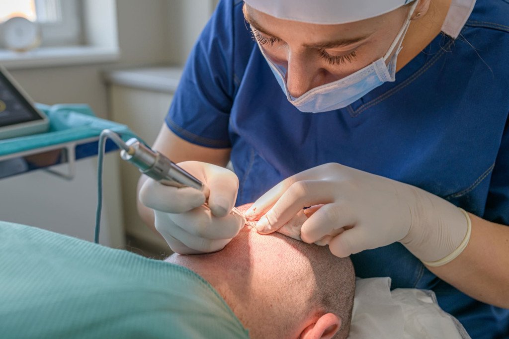 Chirurgien réalisant le prélèvement de greffons lors d'une greffe de cheveux, utilisant des instruments spécialisés.