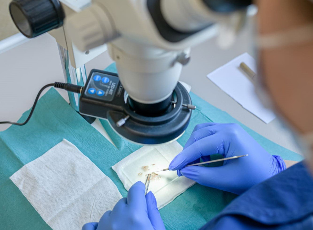 Technicien en greffe de cheveux utilisant un microscope pour trier méticuleusement les greffons.