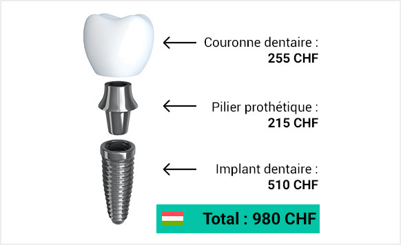 tarif d'un implant dentaire en hongrie