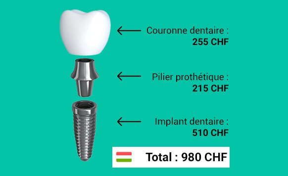 tarif pour un implant dentaire en hongrie, détaillé par composants de l'implant