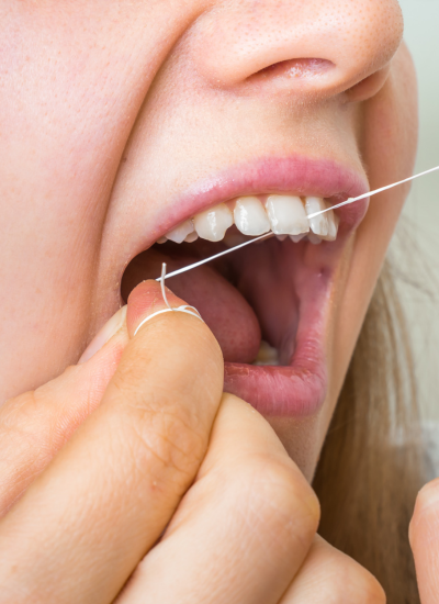 utilisation d'un fil dentaire et brossettes