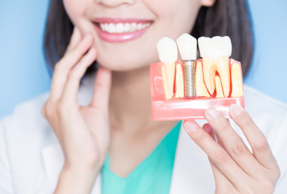 femme qui montre le remplacement des dents avec parodontite (via implant dentaire)