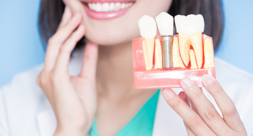 femme qui montre le remplacement des dents avec parodontite (via implant dentaire)