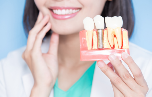 femme qui montre le remplacement des dents avec parodontite (via implant dentaire)
