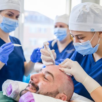 opération d'une greffe de cheveux sur homme, avec un experte en implantation capillaire et ses assistantes