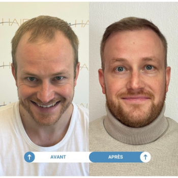 étude de cas fabian