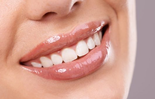 sourire parfait dents blanches et alignées