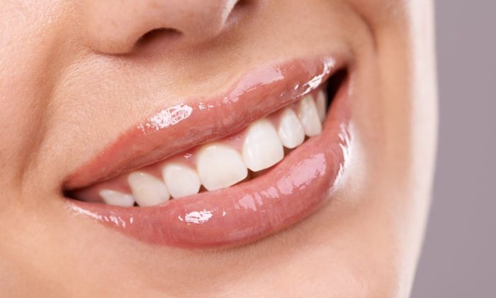 sourire parfait dents blanches et alignées