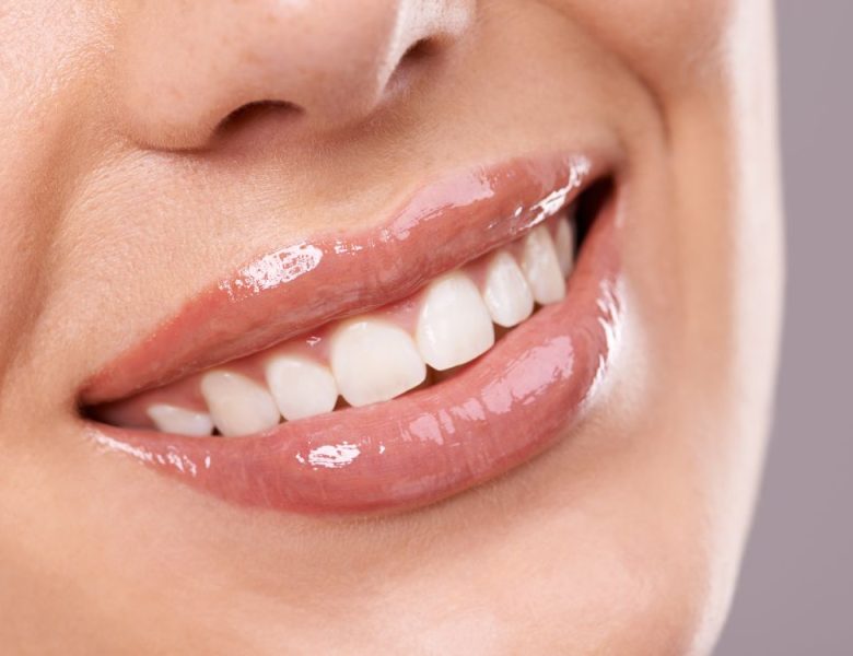 sourire parfait dents blanches et alignées