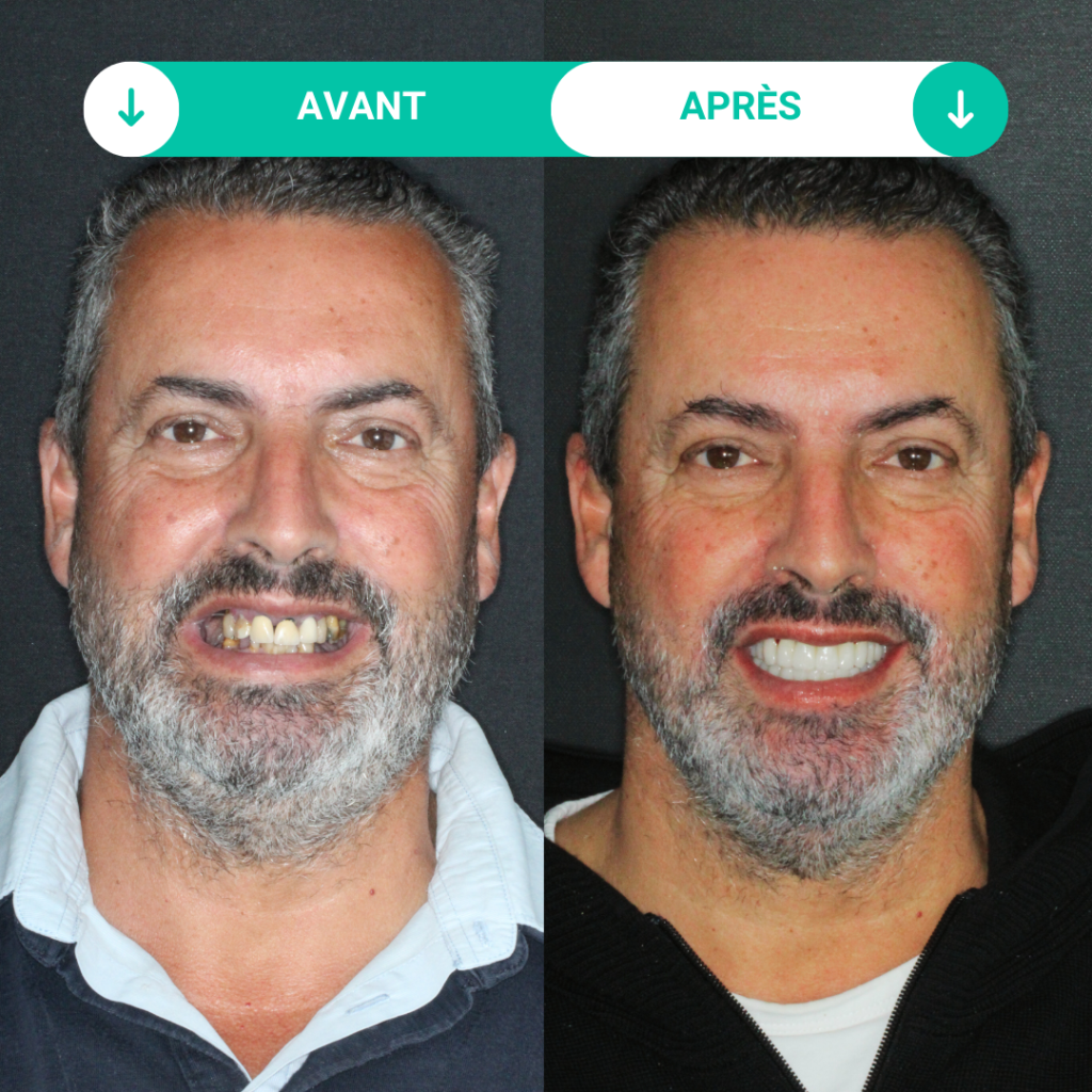 temoignage patient dentaire