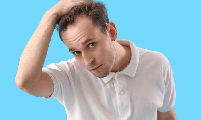 Homme qui observe l'évolution de sa greffe de cheveux