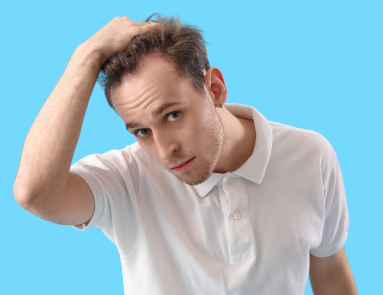 Homme qui observe l'évolution de sa greffe de cheveux