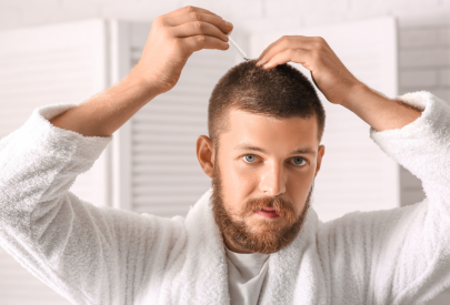 homme qui a fait une greffe de cheveux
