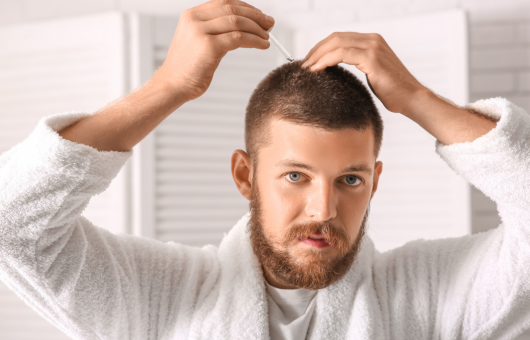 homme qui a fait une greffe de cheveux