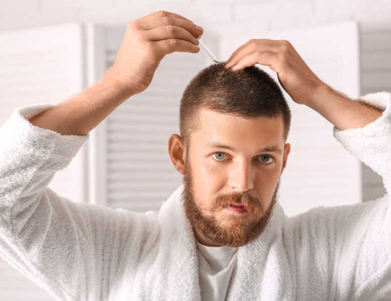 homme qui a fait une greffe de cheveux