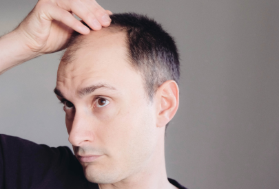 homme qui observe sa perte de cheveux sur les golfes