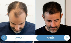 avant après cédric