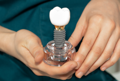 couronne sur implant dentaire