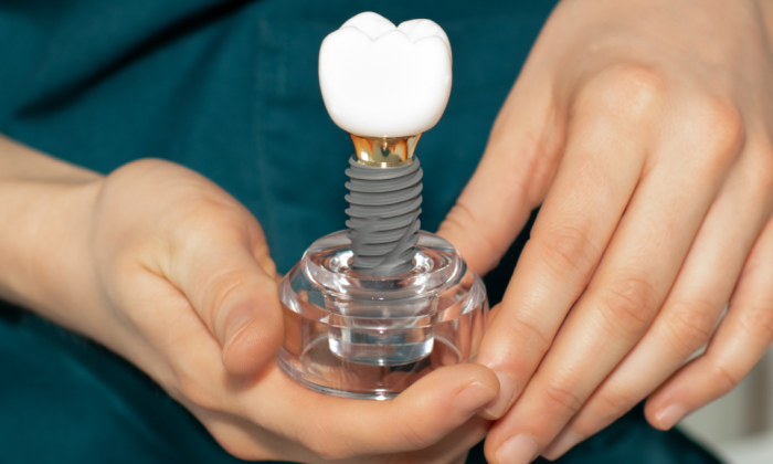 couronne sur implant dentaire