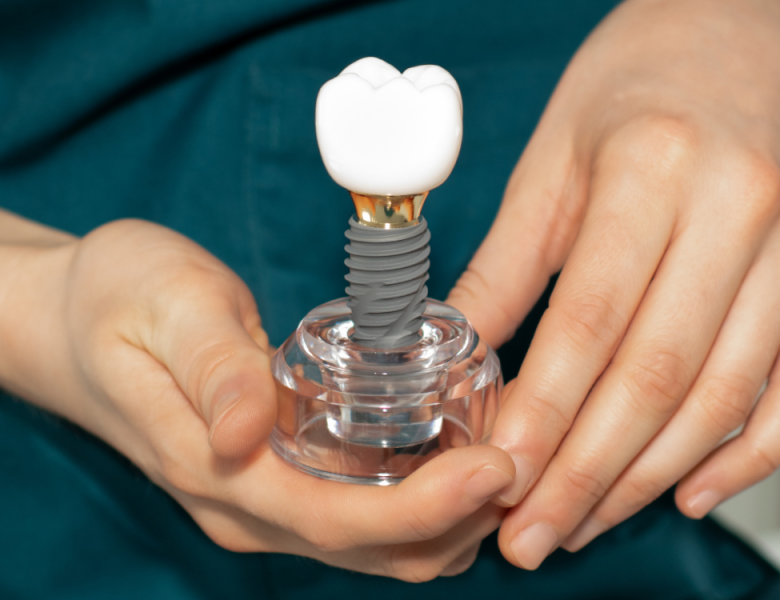 couronne sur implant dentaire