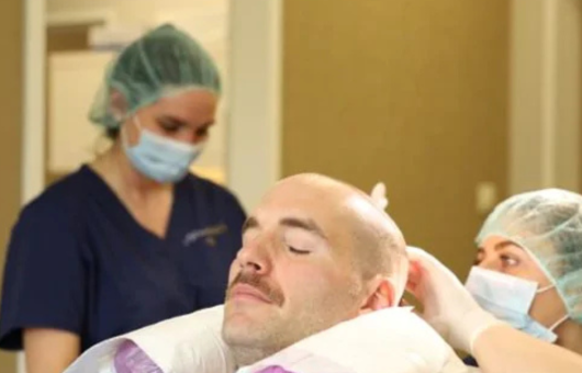 homme qui se fait greffer les cheveux en Turquie