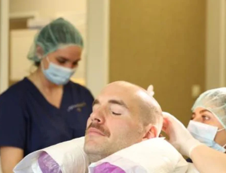 homme qui se fait greffer les cheveux en Turquie
