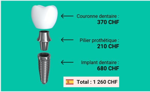 prix CHF implant dentaire espagne