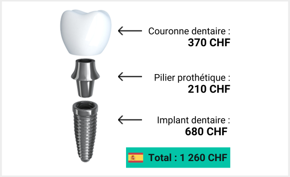 prix CHF implant dentaire espagne