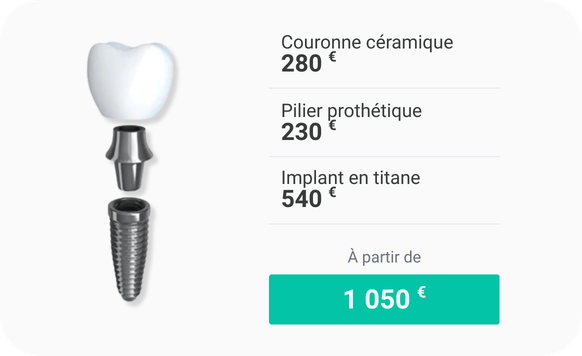 Prix d'un implant dentaire en Hongrie