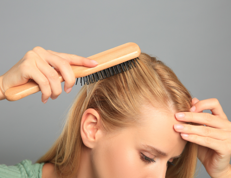 femme qui perd ces cheveux et pense à la greffe de cheveux